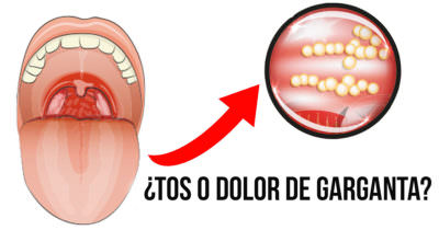remedio casero para la tos