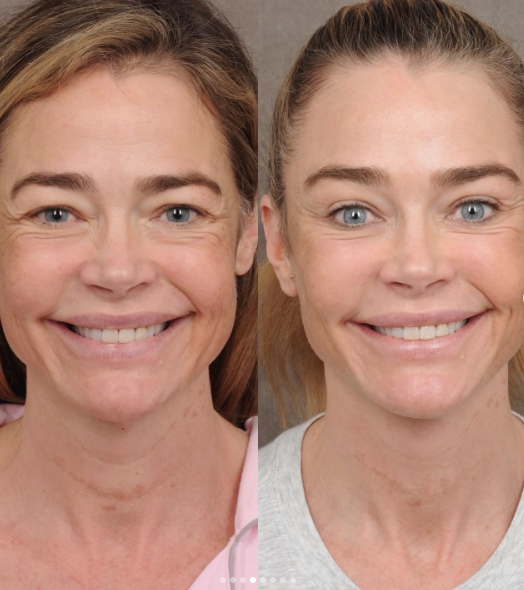 Denise Richards