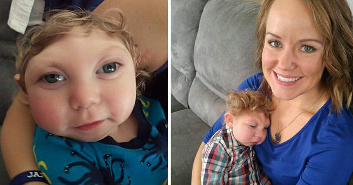 'Miracle baby' born without most of his brain defied all odds tragic