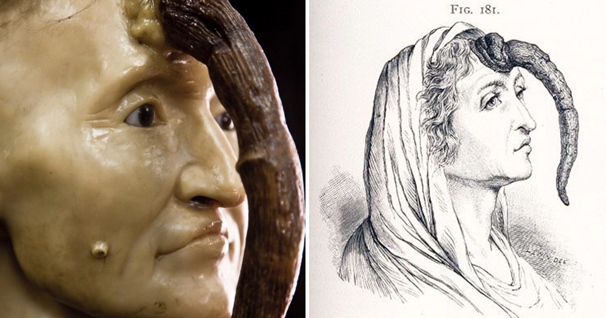 The fascinating story of Madame Dimanche, Paris's horned woman