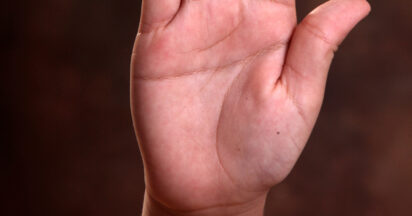 The Simian Line: What it means if you have one on your palm