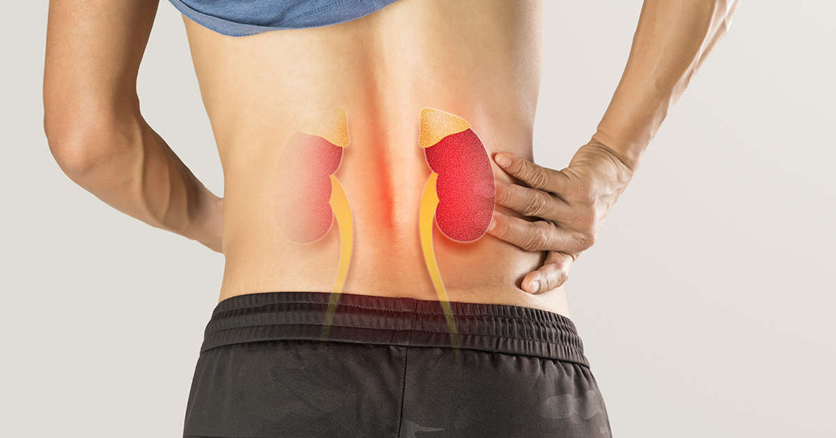 Stock imagine of man with sore kidneys. Credit / Shutterstock