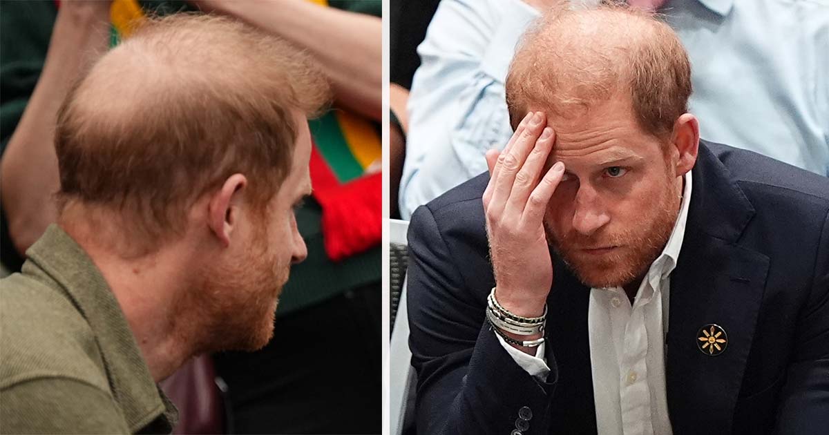 Prince Harry sports huge bald patch in new picture