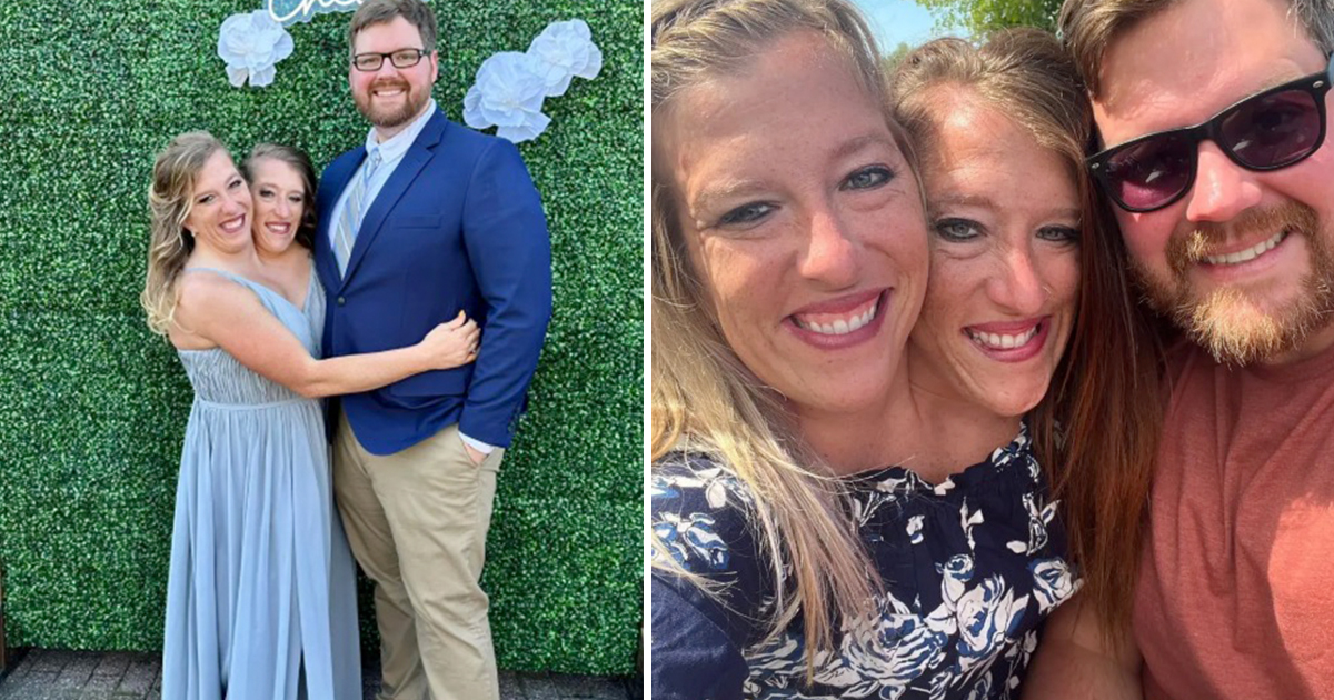 Mom of conjoined twins answers question everyone is asking(00)