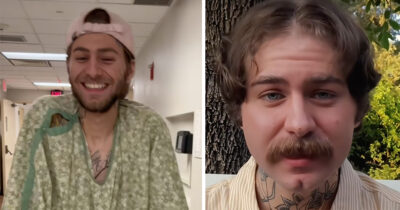 Mikey Stone was diagnosed aged 25. Credit: TikTok