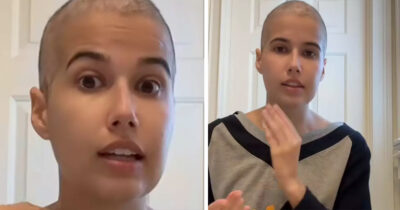 Doctors initially missed one of Anabel's subtle symptoms. Credit: TikTok / a_brenn98