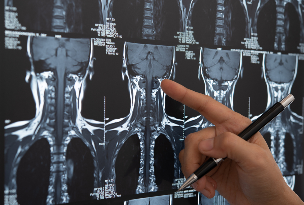 Woman undergoes $2 million extreme human experiment to to "create a repeatable waveform of hundreds of life-critical biomarkers." Credit: Shutterstock
