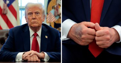 One doctor has claimed Donald Trump suffered a stroke last year. Credit / Getty Images