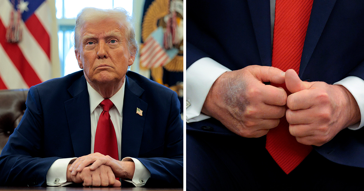 Donald Trump suffered a stroke last year, claims doctor