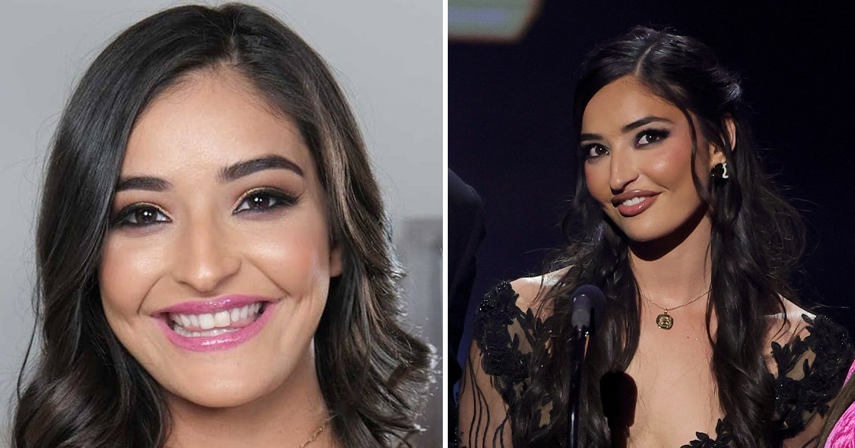 Latest update on adult star Emily Willis who was left ‘permanently paralyzed’