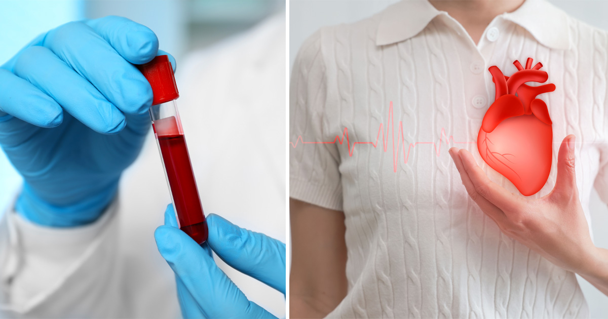 Blood type, heart attack