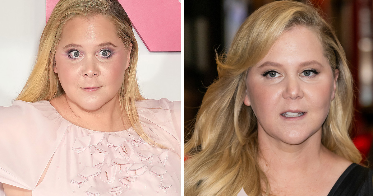 Amy Schumer