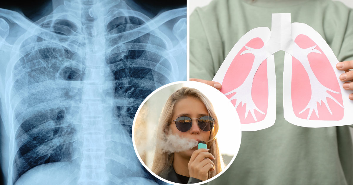 elfbar elfa master akku Can vaping cause cancer? The evidence suggests it might