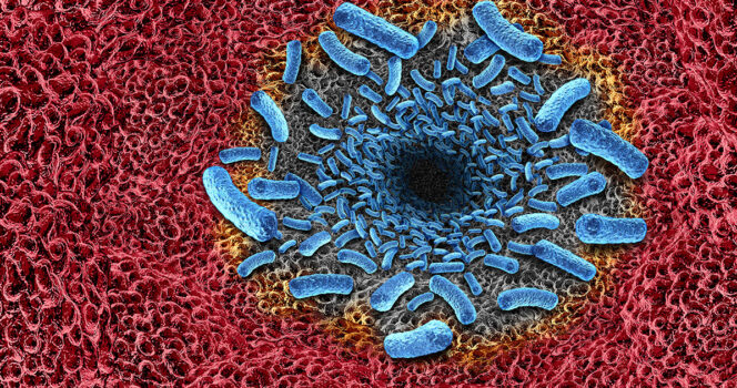 Credit: Getty Images