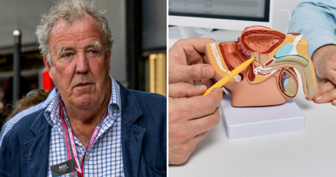 Jeremy Clarkson, Prostate cancer