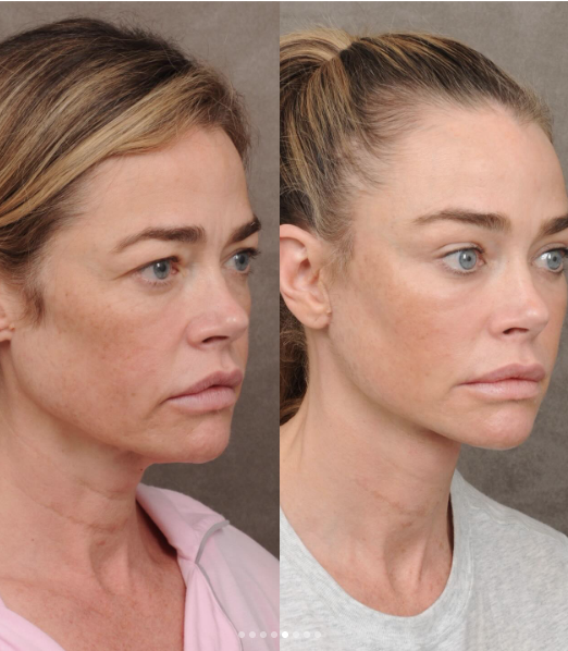 Denise Richards