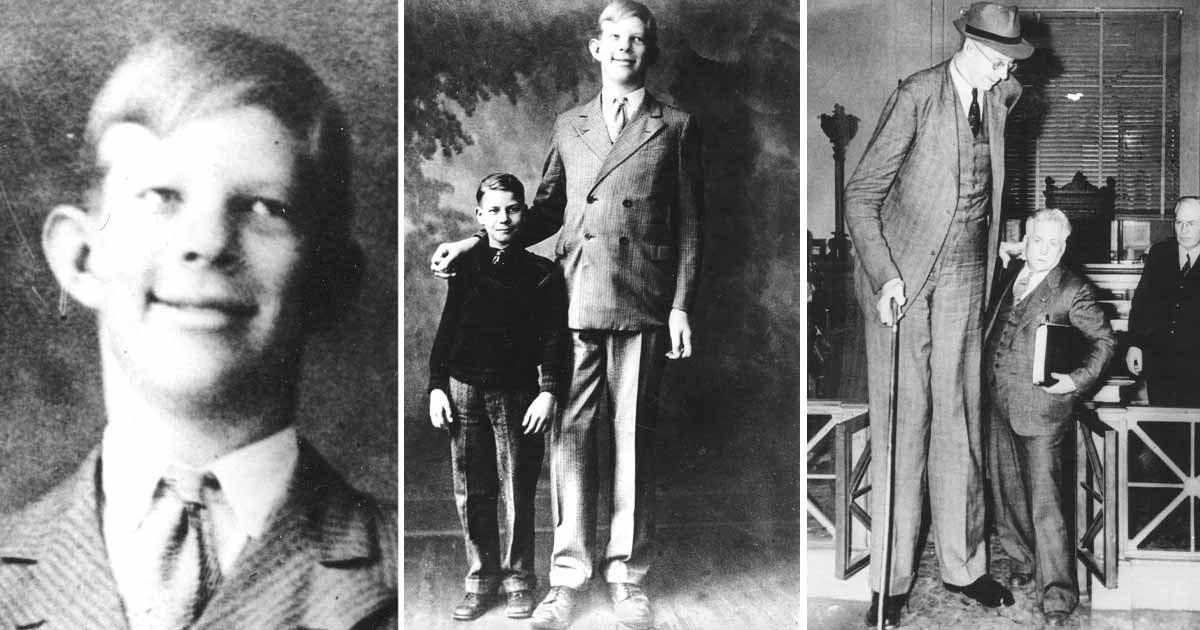 Robert Wadlow, världens längsta människa. Foto: AP Photo/TT