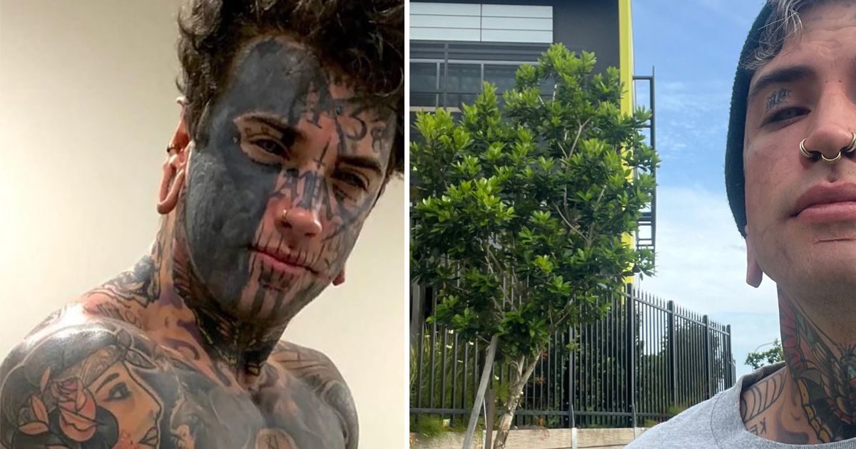 Ethan ”ModBoy” Bramble tog bort sina tatueringar