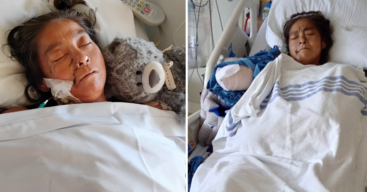 Janelle attackerades av två hundar