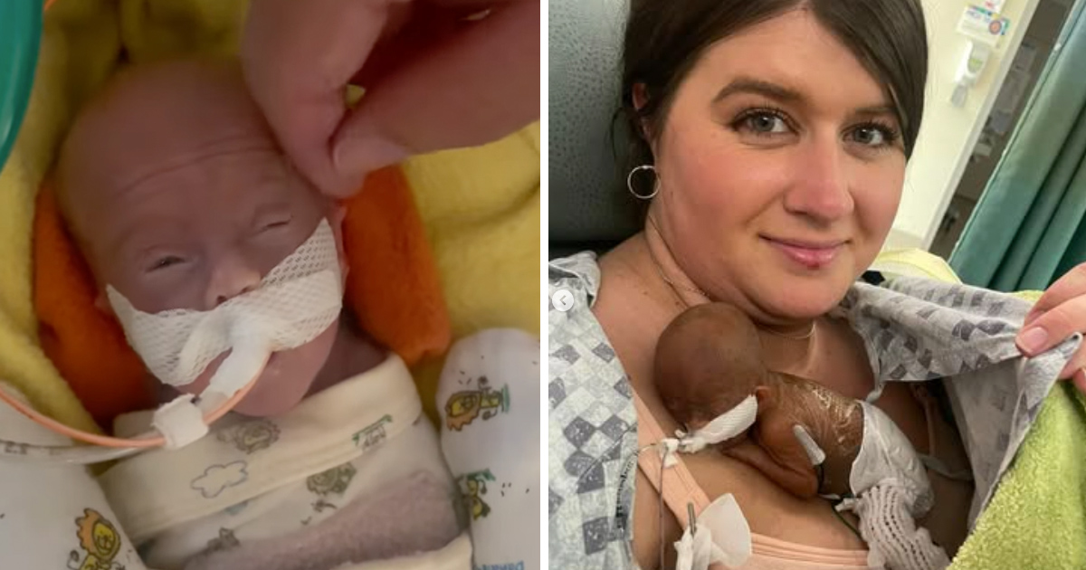 Nash är världens tidigast födda bebis