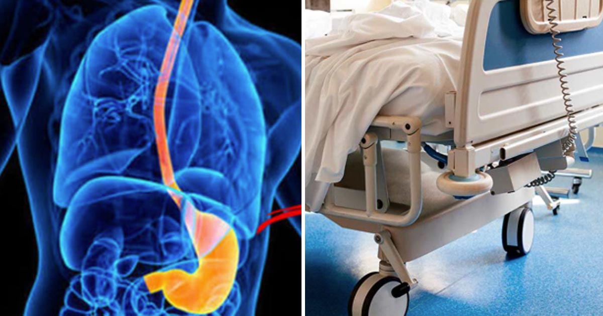 Halsbränna visade sig vara esofaguscancer.