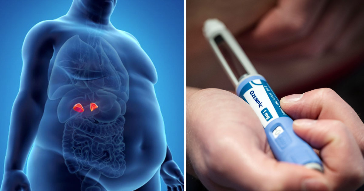 Läkemedel med semaglutid tycks skydda mot hjärt-kärlsjukdom och inte bara kopplat till viktnedgång. Arkivbild.