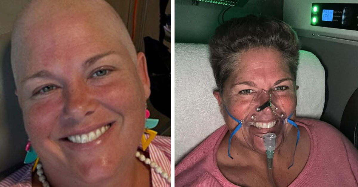 Susan Schmidt har tarmcancer i fjärde stadiet