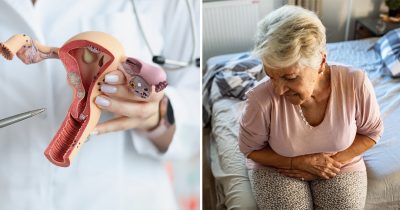 Då ska du söka vård för äggstockscancer