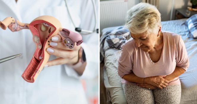 Då ska du söka vård för äggstockscancer