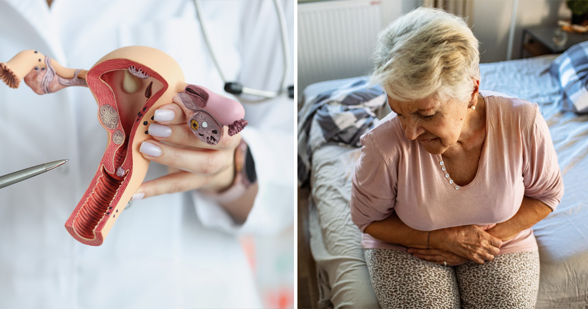 Då ska du söka vård för äggstockscancer