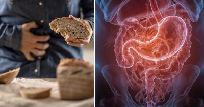 Celiaki – glutenintolerans