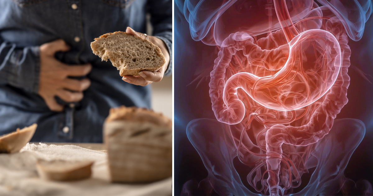 Celiaki – glutenintolerans