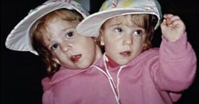 bliźniaczki syjamskie Abby i Brittany Hensel