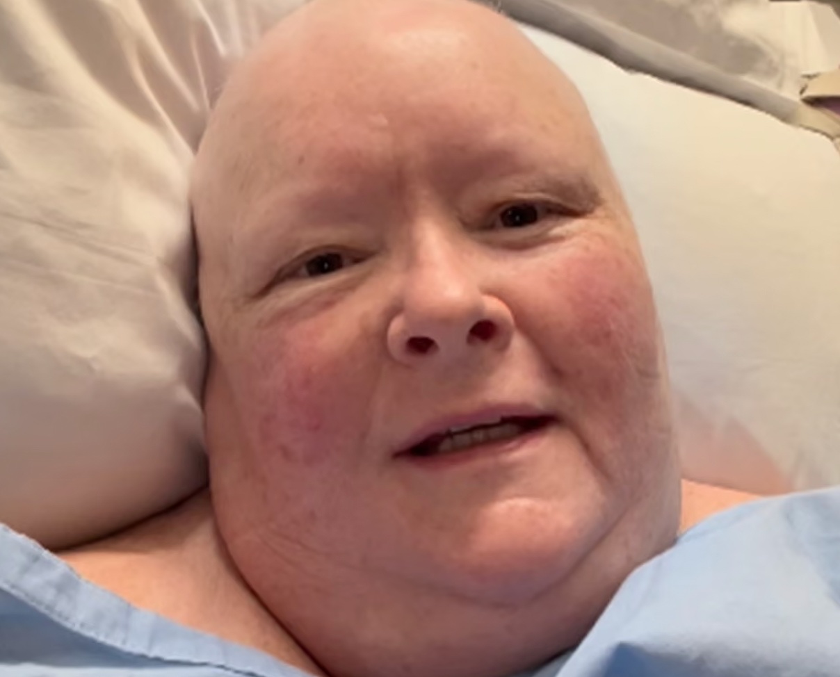 Magda Szubanski. w szpitalnym łóżku