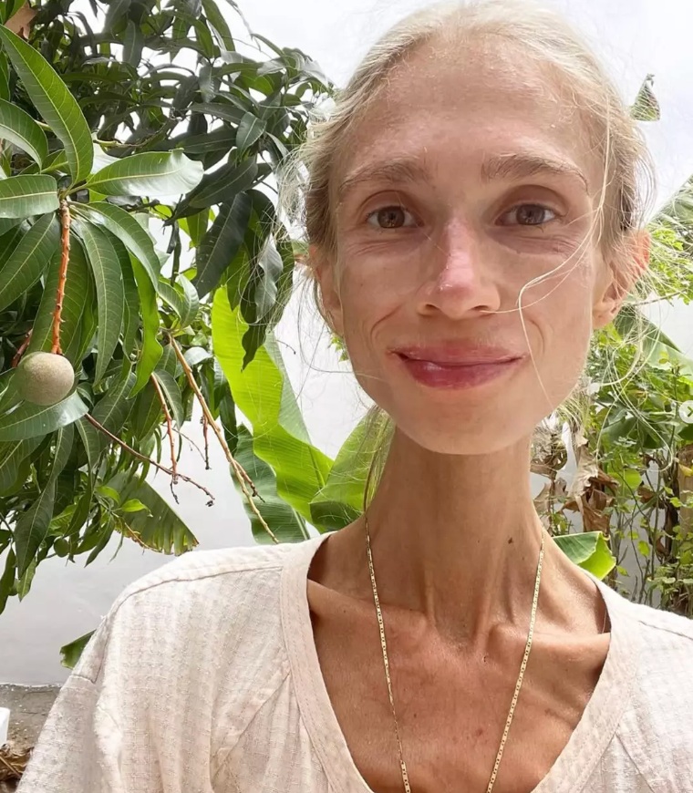 Karolina Krzyżak zmarła stosując restrykcyjną dietę owocową