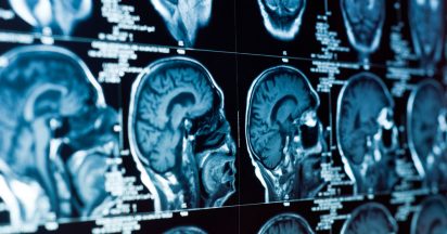 zdjęcia z badania mózgu
