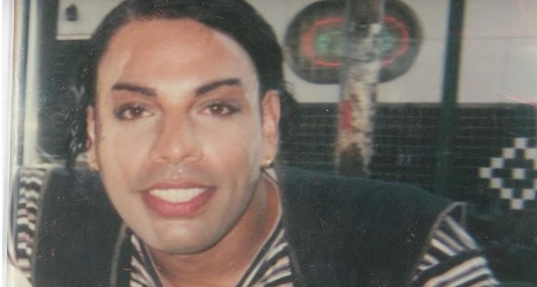 Rajee Narinesingh przed zabiegami