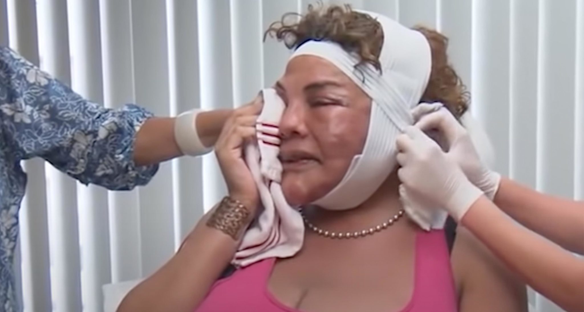 Rajee Narinesingh z opatrunkiem na głowie po zabiegu