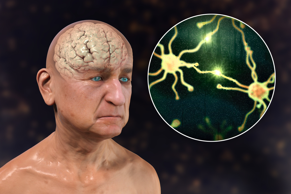 grafika z człowiekiem, mózgiem i neuronami