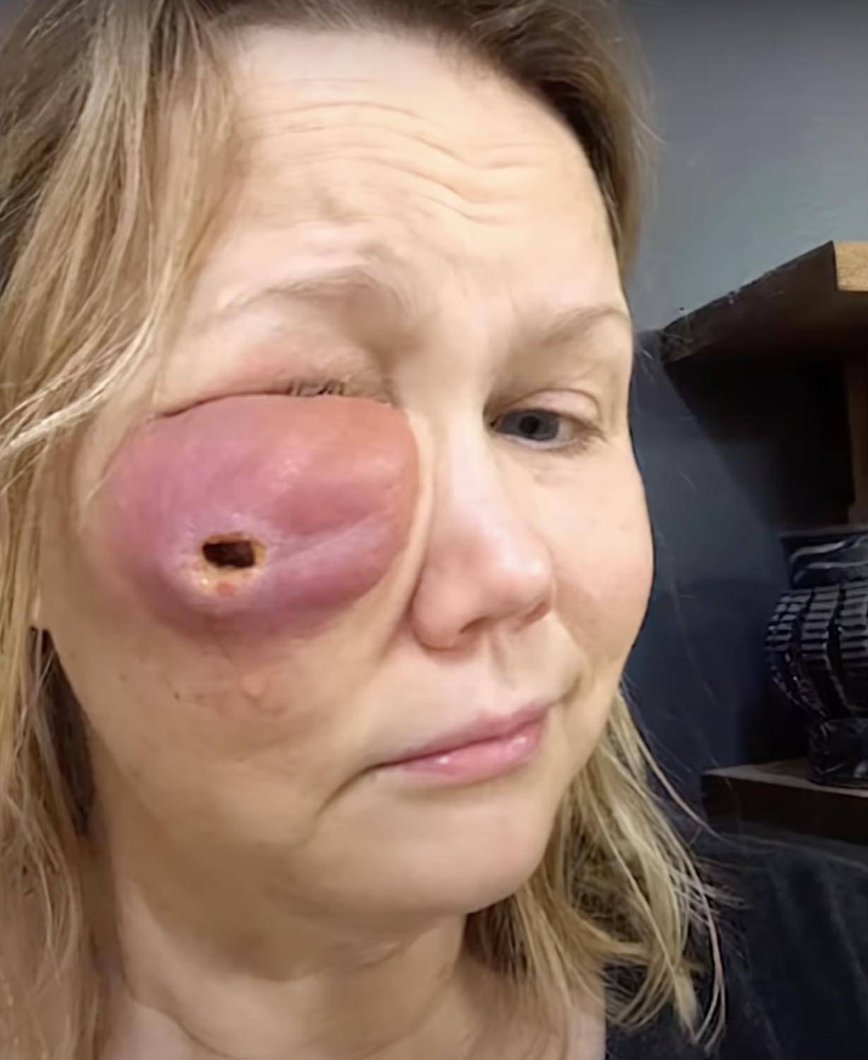 Gina Anderson z ziarniakiem na twarzy