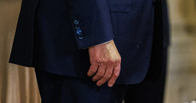 Outo yksityiskohta Donald Trumpin kädessä herätti jälleen kaikkien huomion.