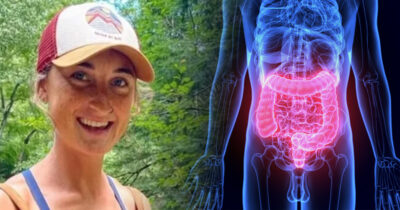 Rylie Toomey ja paksusuoli. GoFundMe ja Shutterstock