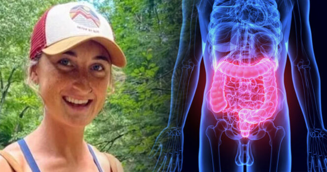 Rylie Toomey ja paksusuoli. GoFundMe ja Shutterstock