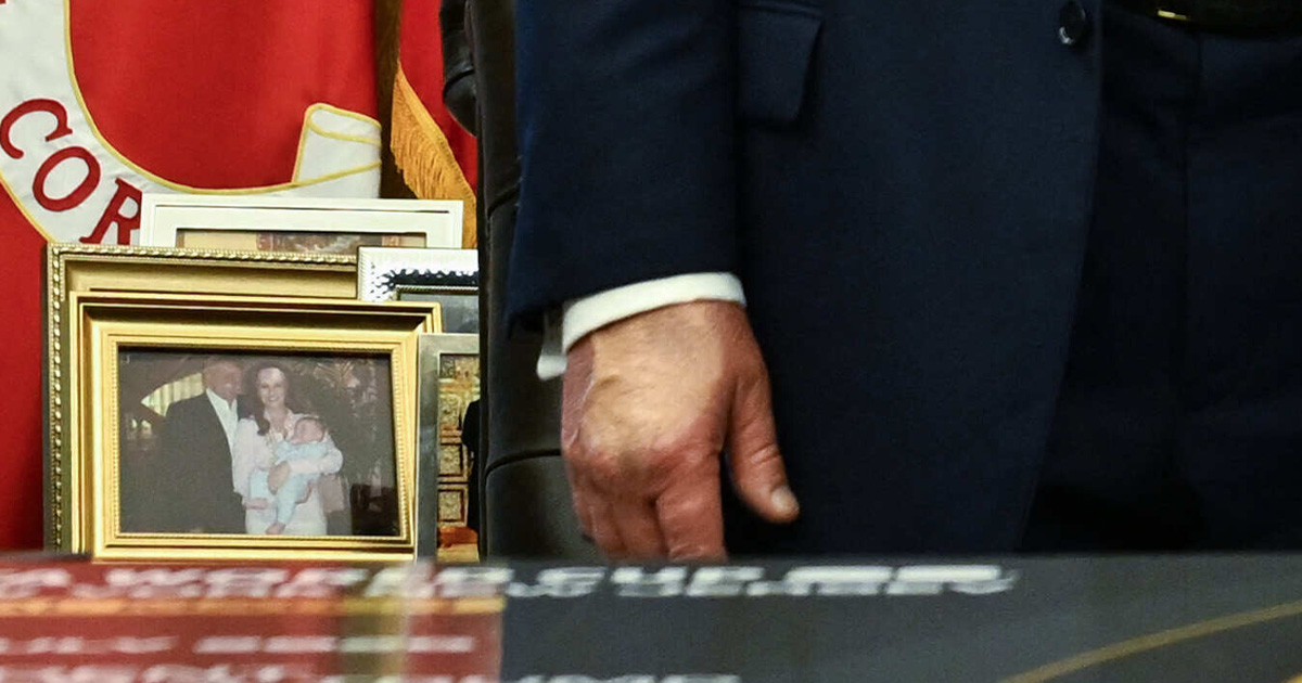 Trumpin oikean käden kämmenselkä erosi väritykseltään selvästi muusta ihosta.