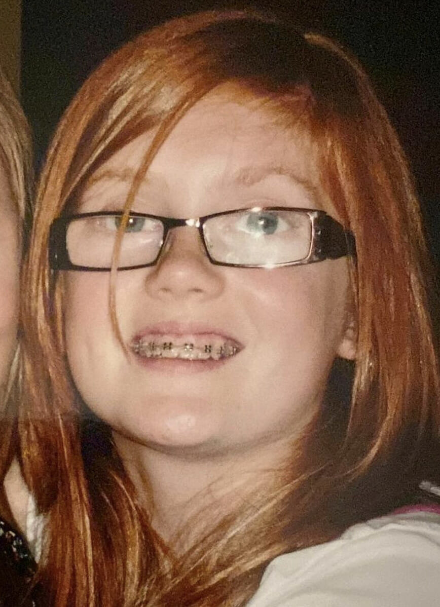 Jessica Gagenia kiusattiin lapsena rajusti hänen hiustensa takia.
