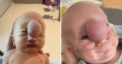 Vauva Liam ison aivotyrän kanssa. Kuva TikTok/ @hannahsachs17