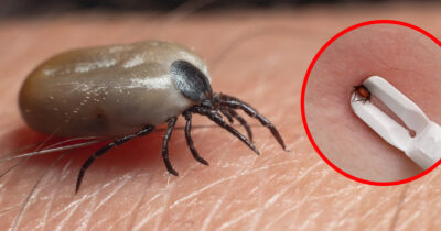 Punkkien ja niiden levittämän borrelioositapausten määrrässä on tapahtunut raju kasvu tänä vuonna.