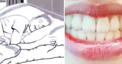 Mitä tarkoittaa kun hampaat putoavat unessa?