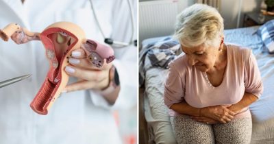 Munasarjat. Nainen kouristelee. Kuvat:Shutterstock