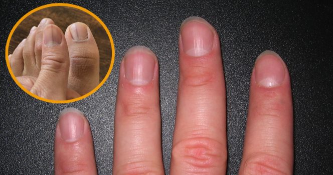 Kuvat kynistä joissa raidat ja ilman.